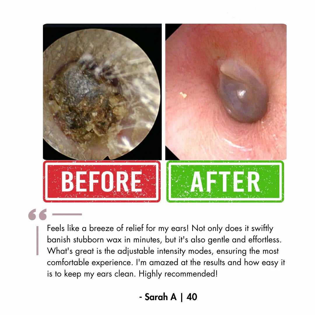 Electric Ear Wax Removal Kit with LED Display