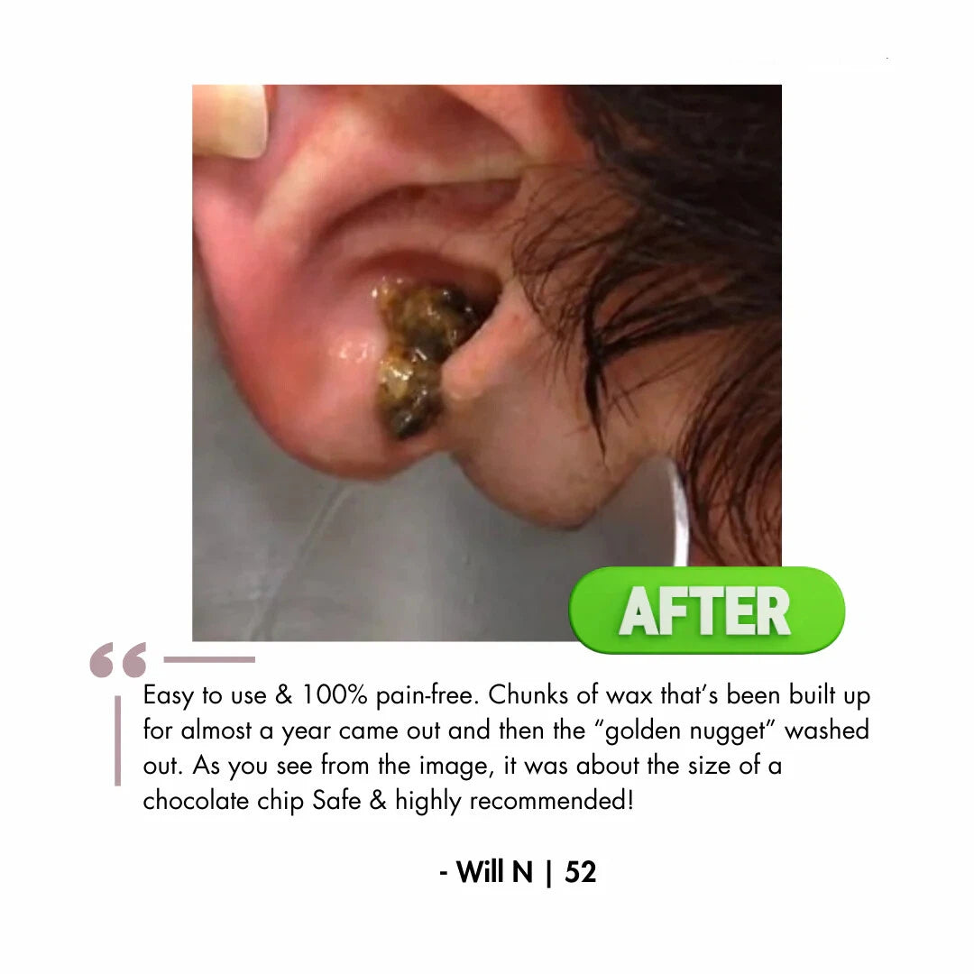 Electric Ear Wax Removal Kit with LED Display