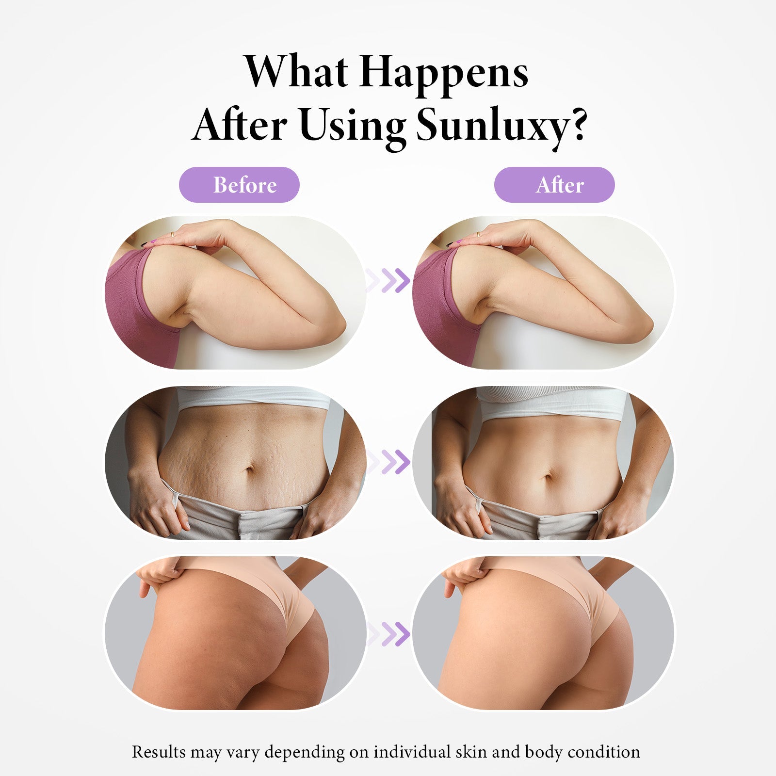 Sunluxy Body Sculpting Device