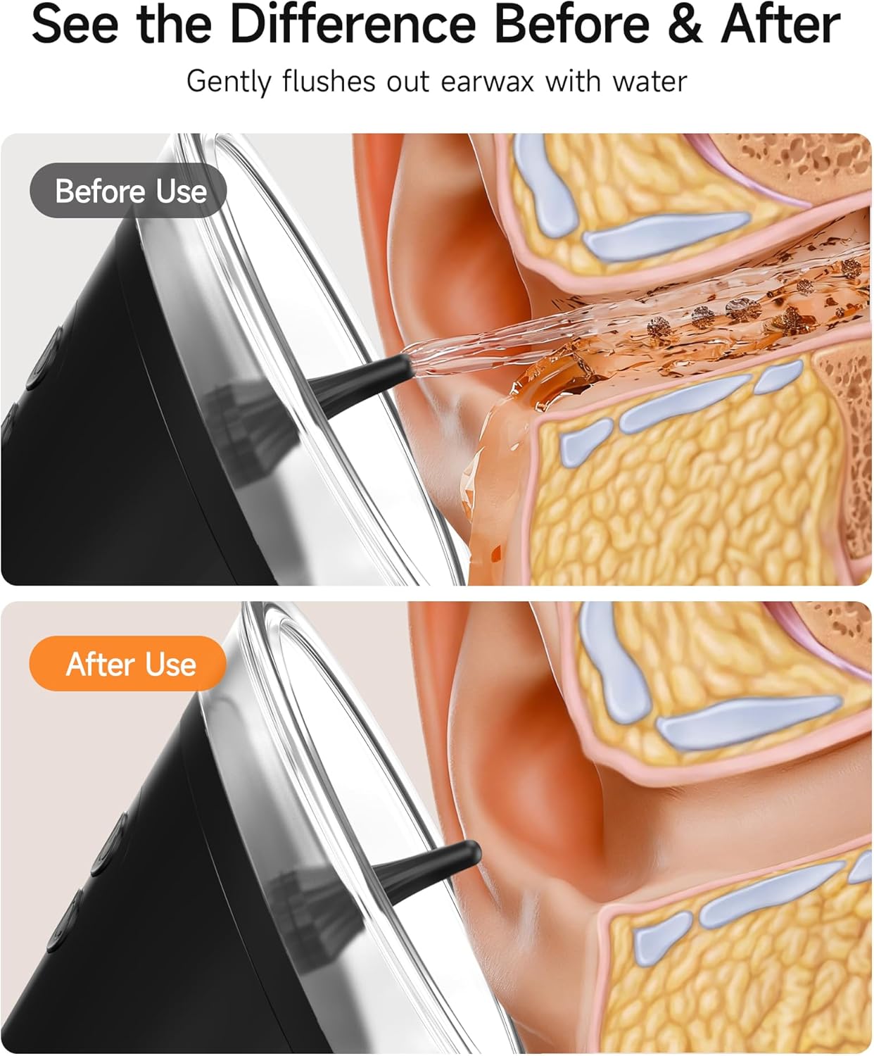 Renergy Electric Ear Wax Removal Kit with LED Display, Powered Ear Wax Remover, Dual Clean & Waste Tank, Water Ear Cleaner & Ear Cleaning Kit, Ear Irrigation Flushing System, 3 Modes, 12 Nozzles, IP67