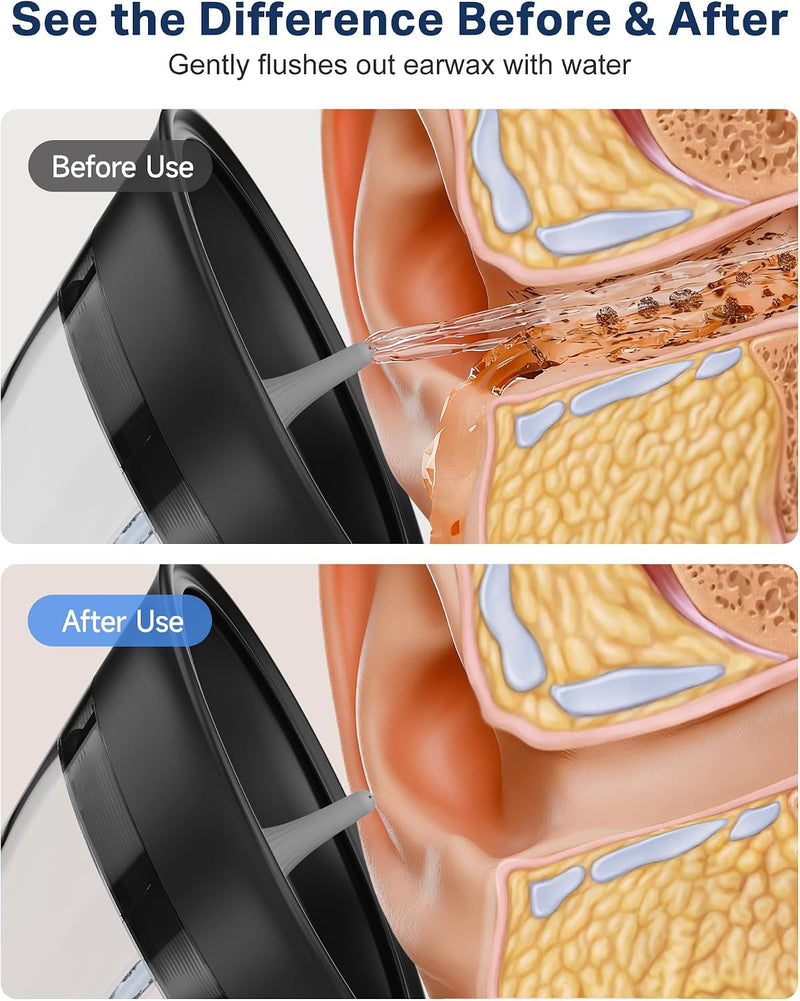 Ear Wax Removal, Water Temp Sensor