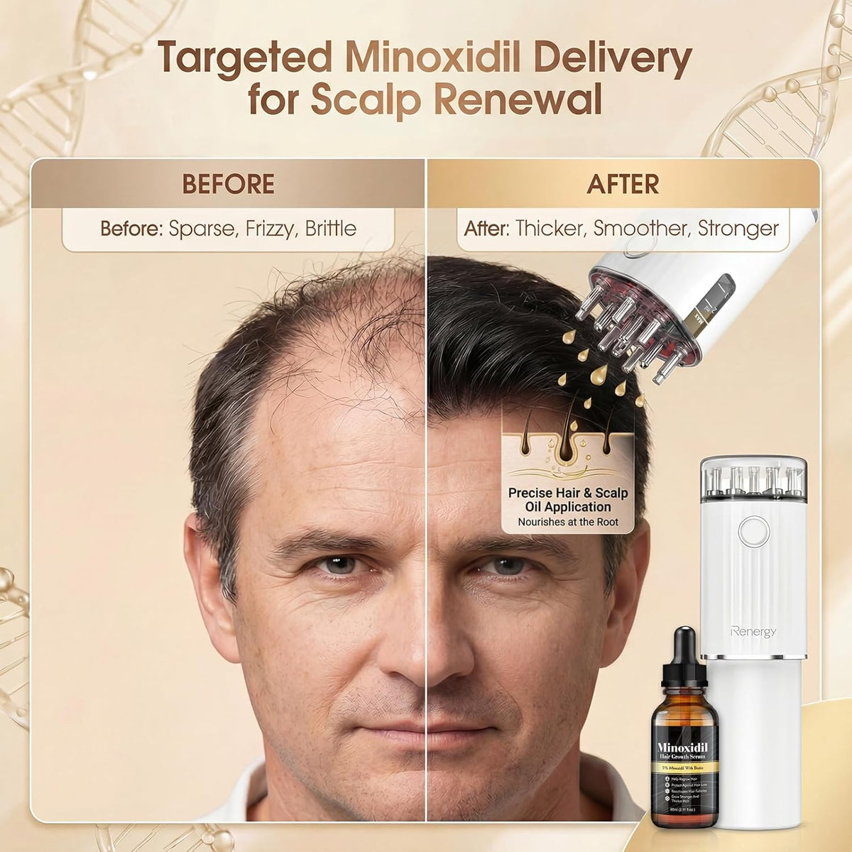 Renergy Electric Hair Oil Applicator for Scalp, Red Light Therapy Direct Brush with Vibration & Microcurrent, Minoxidil Applicator Tool, Serum Dispenser, Electric Scalp Massager Comb for Hair Growth