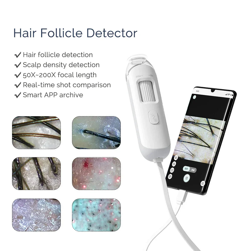 Smart Portable Scalp Hair Follicle Detector